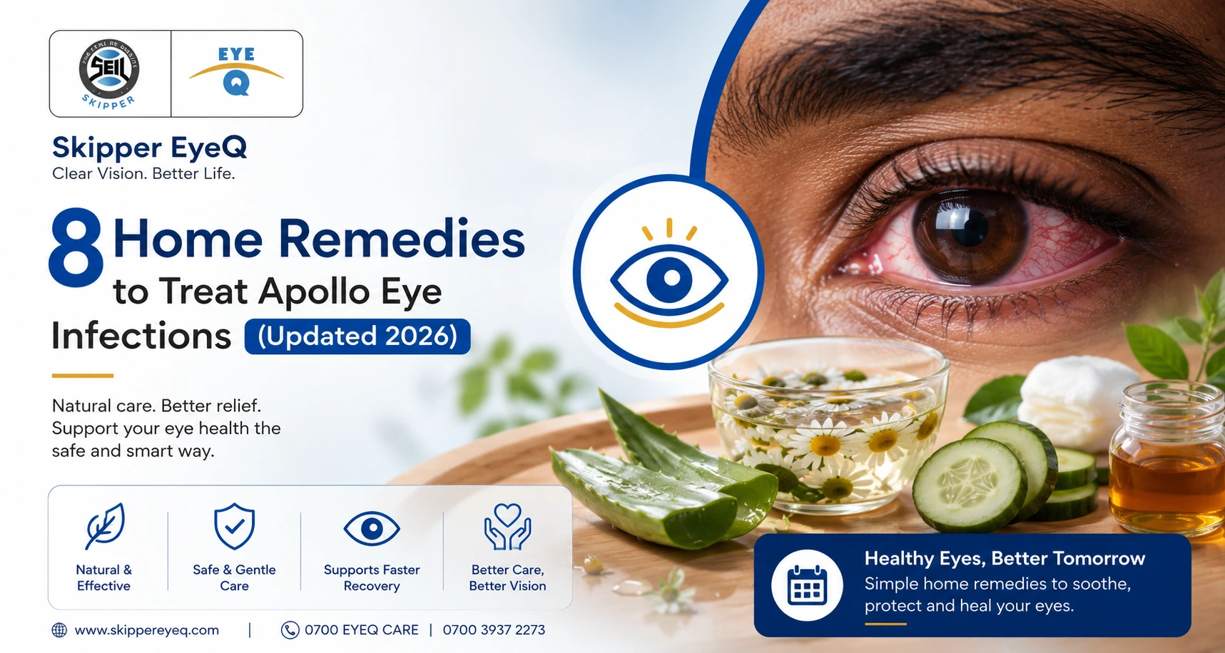8 Home Remedies to Treat Apollo Eye Infections