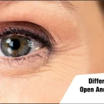 Difference Between Open And Closed Angle Glaucoma
