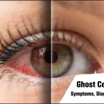 Ghost Cell Glaucoma
