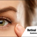 retinal detachment