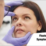 Floaters and Flashes