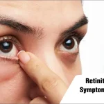 Retinitis Pigmentosa