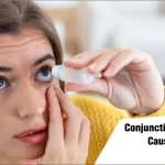 Conjunctivitis (Pink Eye)