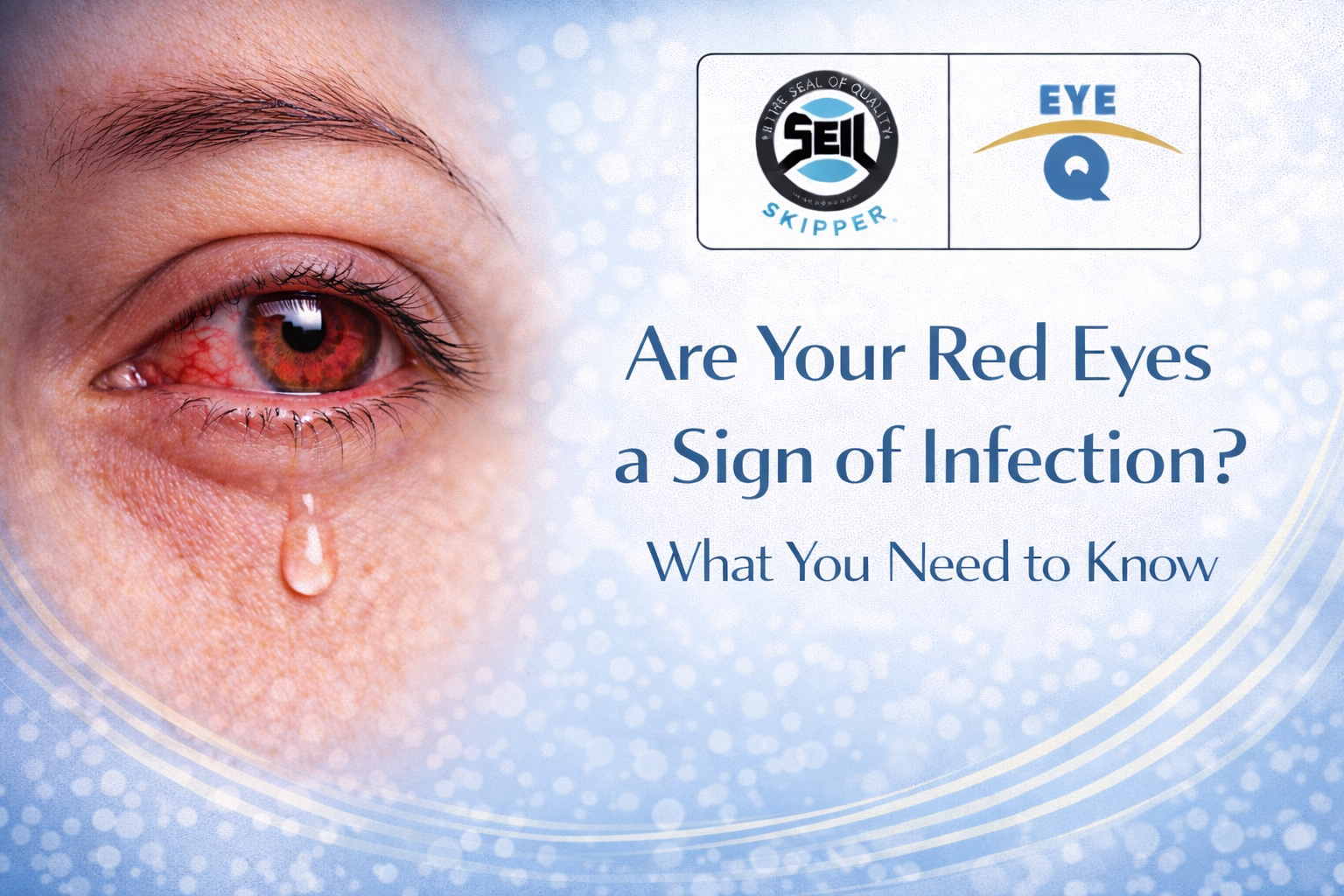 Red Eyes a Sign of Infection