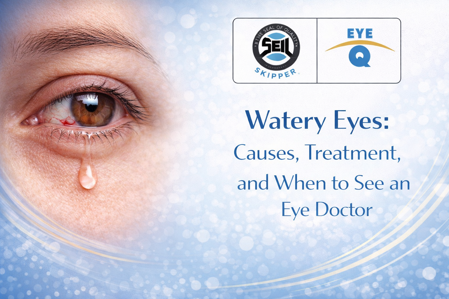 watery eyes