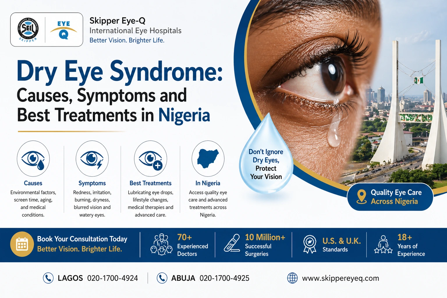 Dry Eye Syndrome
