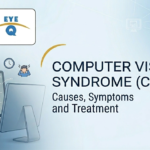 Computer Vision Syndrome