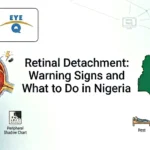 Retinal Detachment