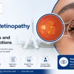 Diabetic Retinopathy in Nigeria