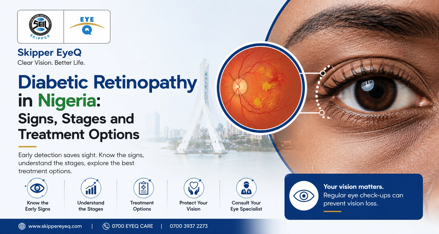 Diabetic Retinopathy in Nigeria
