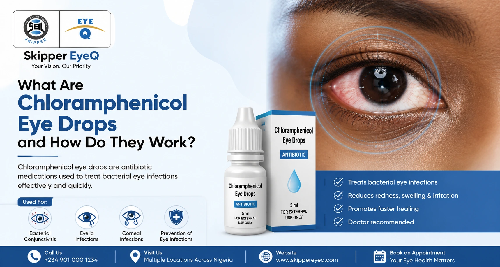 What Are Chloramphenicol Eye Drops and How Do They Work